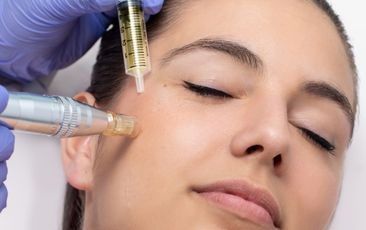 sueroterapia en el tesoro